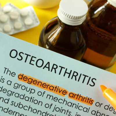 Osteoarthritis &#8211; Dos and don&#8217;ts