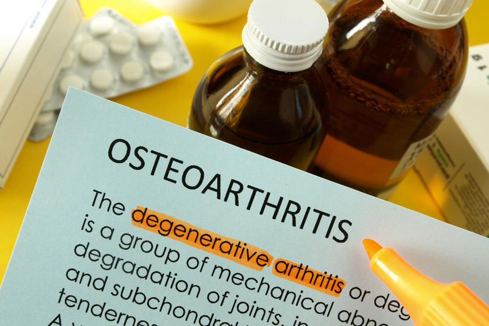 Osteoarthritis &#8211; Dos and don&#8217;ts