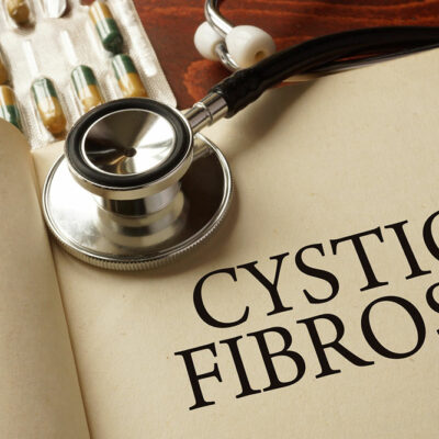 An overview of cystic fibrosis