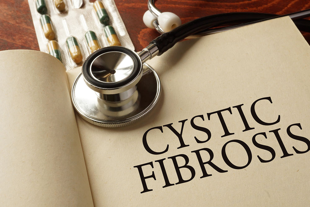 An overview of cystic fibrosis