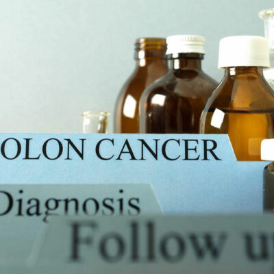 Causes and signs of colon cancer