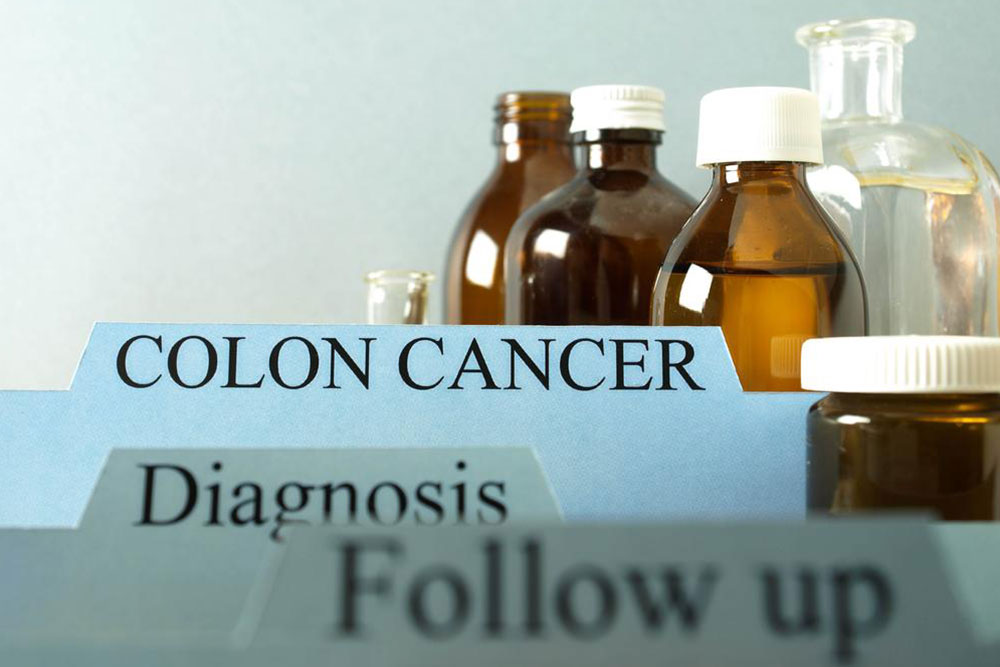 Causes and signs of colon cancer