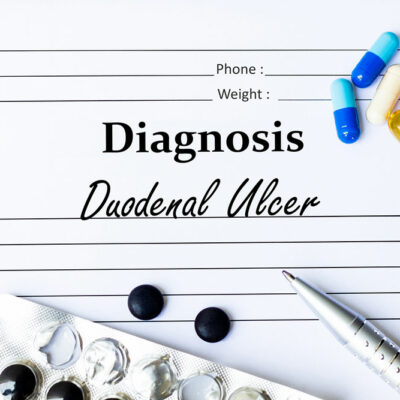Duodenal ulcer &#8211; Causes and symptoms