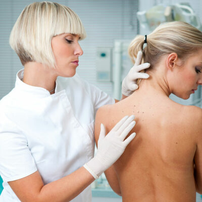 Diagnosing and treating melanoma skin cancer
