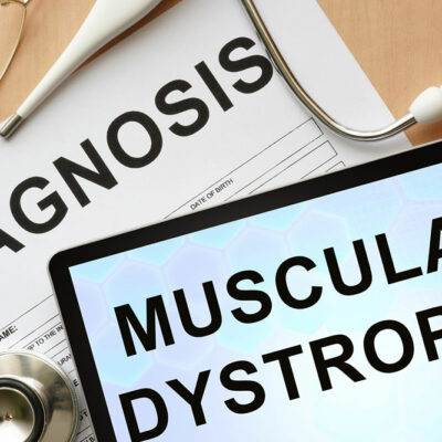 Diagnosis of muscular dystrophy