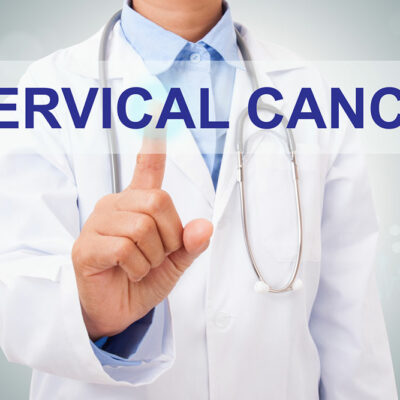 Stages of cervical cancer and the associated signs