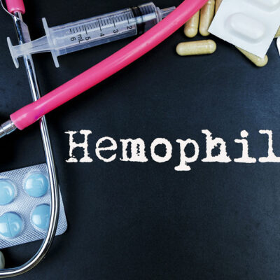 Six easy and effective tips to manage hemophilia