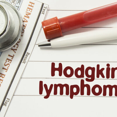 Things you need to know about Hodgkin&#8217;s Disease