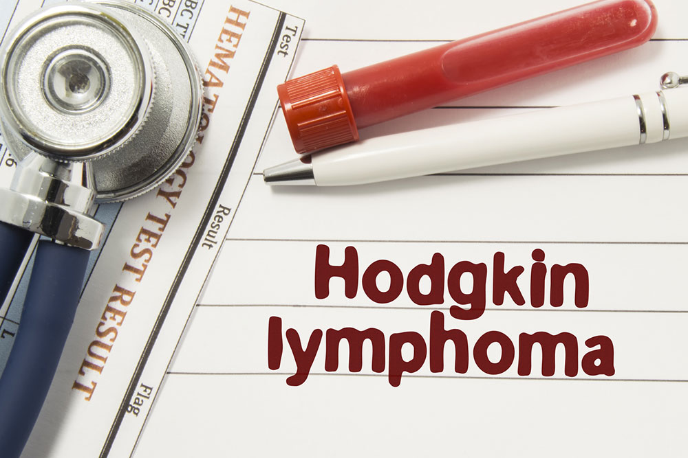 Things you need to know about Hodgkin&#8217;s Disease