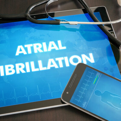 Things you need to know about atrial fibrillation
