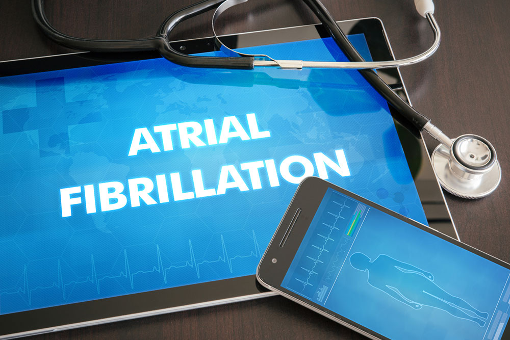 Things you need to know about atrial fibrillation