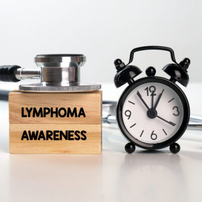 Non-Hodgkin&#8217;s lymphoma: Causes, symptoms, and treatment