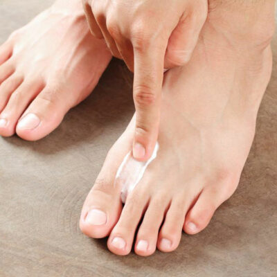 5 tips to follow if you want to prevent athlete’s foot