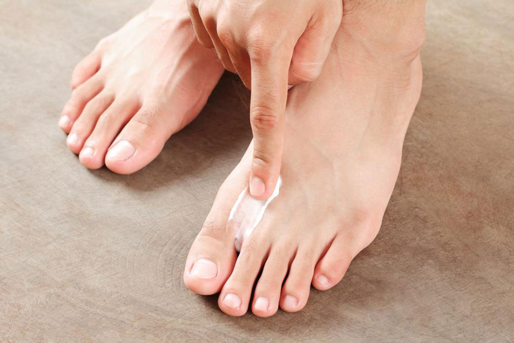 5 tips to follow if you want to prevent athlete’s foot