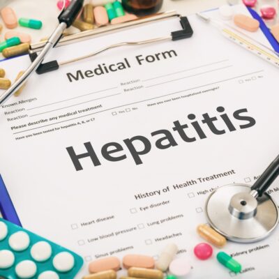 7 Common Early Symptoms of Hepatitis C