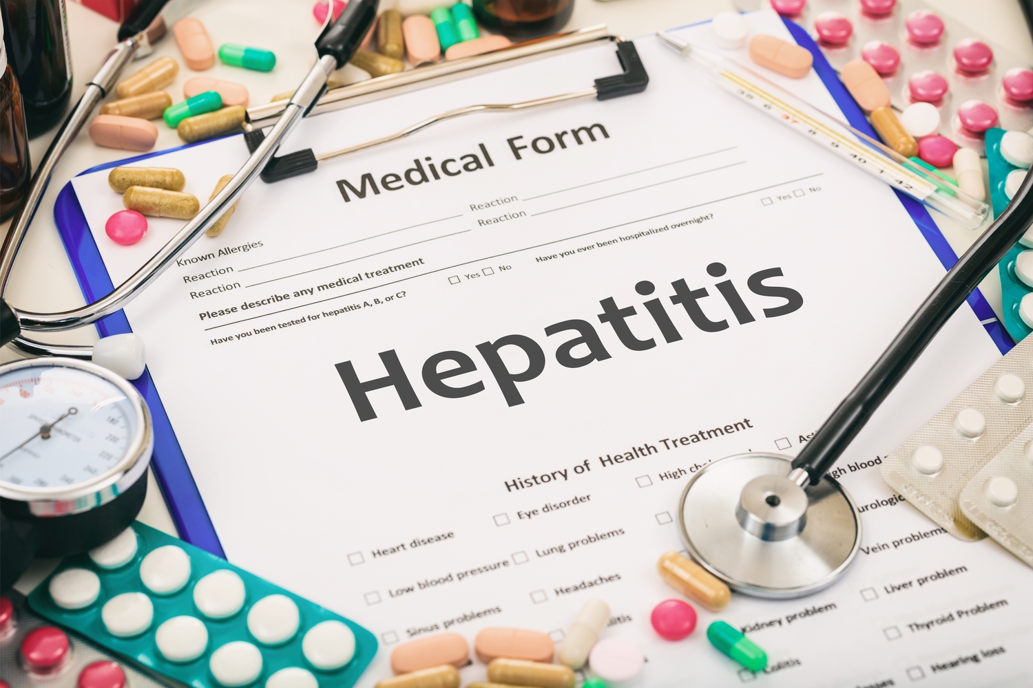 7 Common Early Symptoms of Hepatitis C