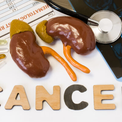 Early Symptoms of Kidney Cancer