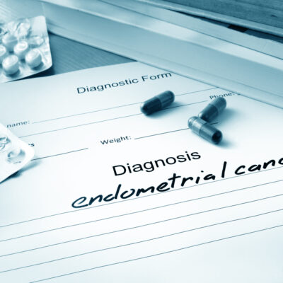 The Lesser-Known Stages and Symptoms of Endometrial Cancer