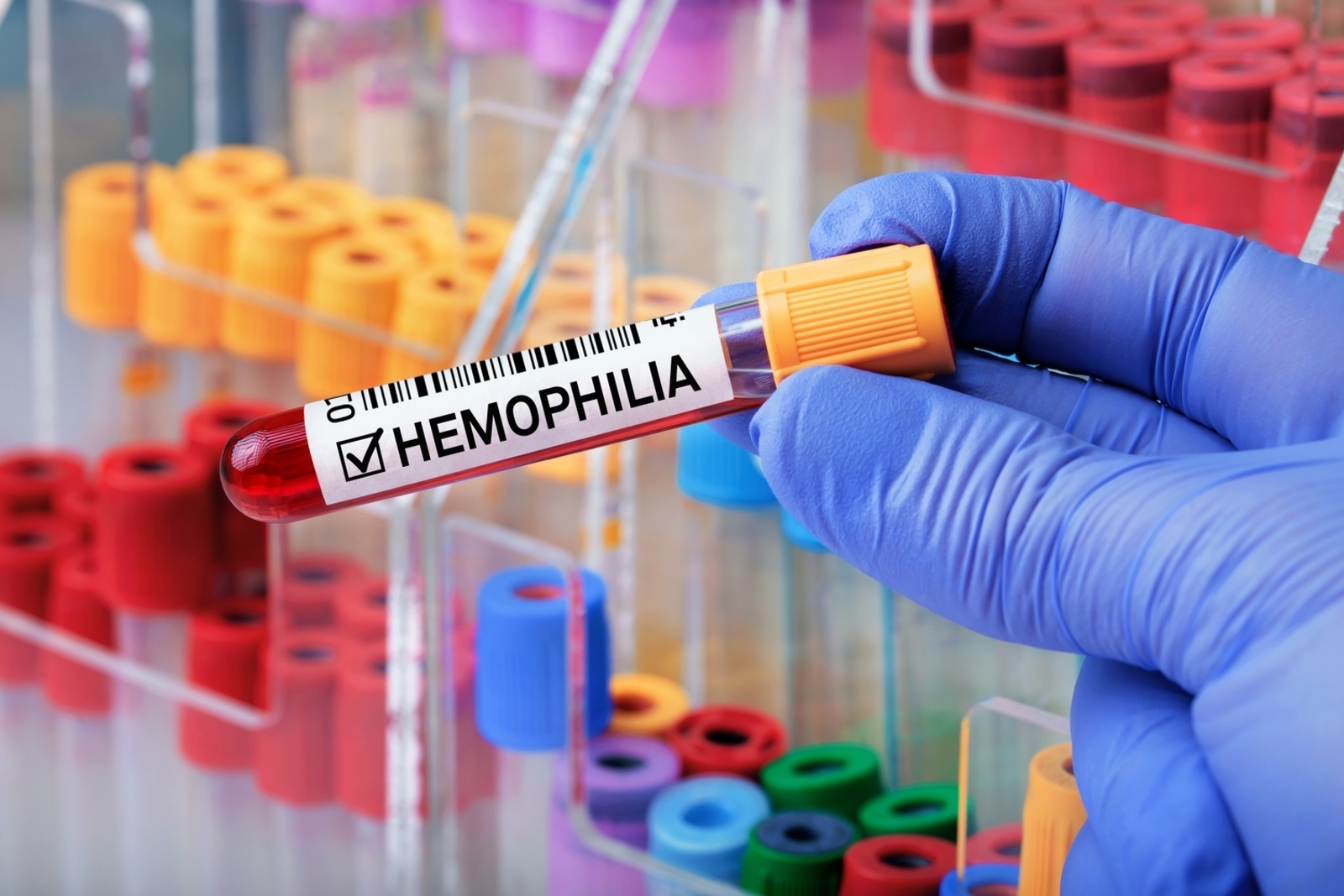 5 Common Symptoms of Hemophilia