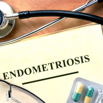 5 Early Signs of Endometriosis